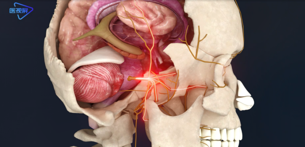 三叉神经影像解剖位置图片