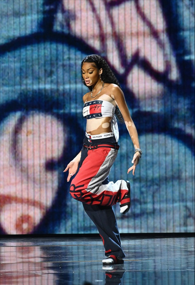 奶牛超模穿衣有魄力,穿抹胸不算,用高腰底裤配低腰运动裤挺特别