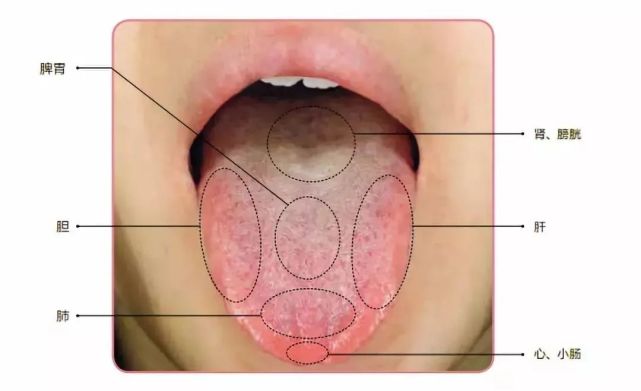 血虛痰溼脾虛怎麼通過舌頭看出來教你一招幫你判斷