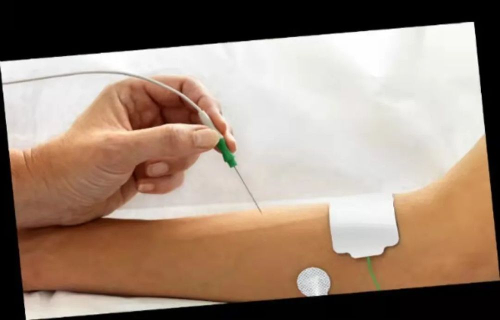 揭开肌电图检查的神秘面纱_腾讯新闻