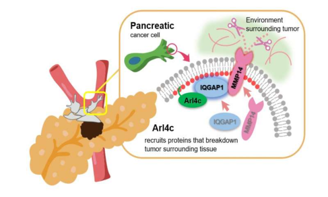 大多数与胰腺癌相关的死亡是由于肿瘤侵入其他器官时发生了转移.