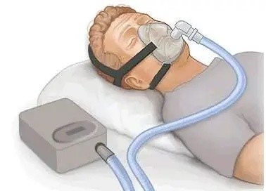 肥胖是原罪么不止高血压糖尿病还有睡眠呼吸暂停