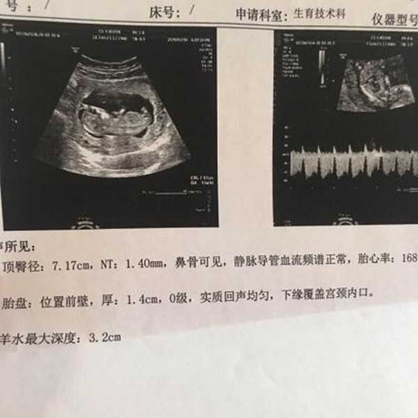 nt三个亮点是男孩女孩 男孩女孩生殖特征点区别_腾讯新闻