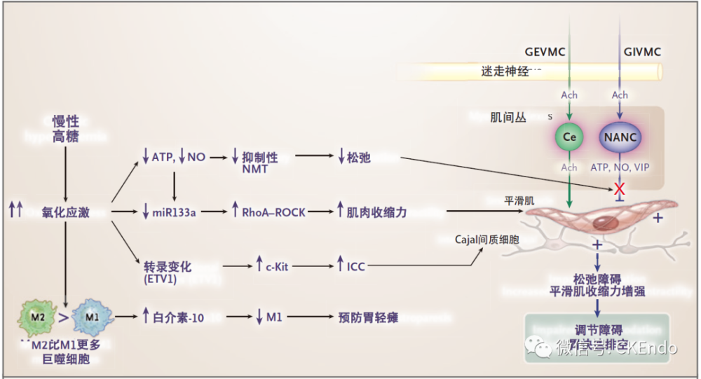 圖3 糖尿病胃排空障礙的發病機制由於抑制性傳遞受損和平滑肌收縮性