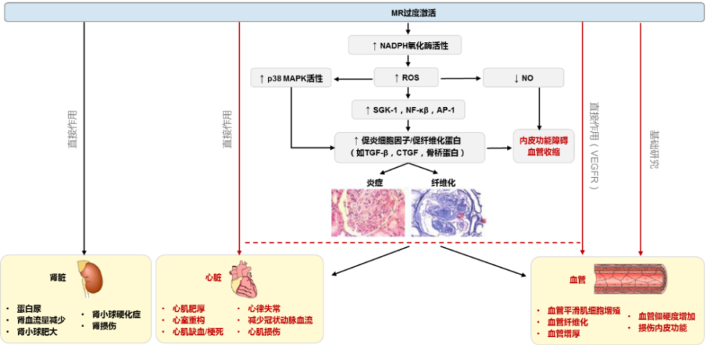 及心肌凋亡等,造成心肌細胞損傷,心肌重構和纖維化,進而引起心力衰竭