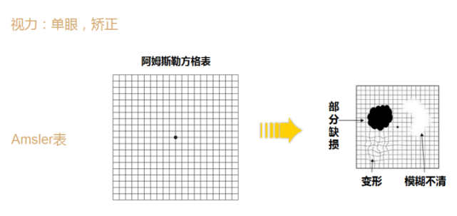 阿姆斯勒方格表是什么图片