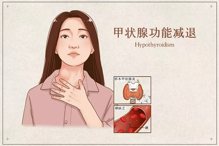 甲亢和甲减的区别 腾讯网