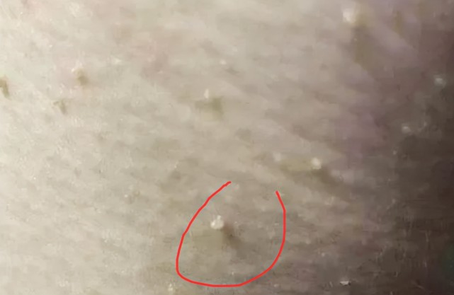 腾讯内容开放平台