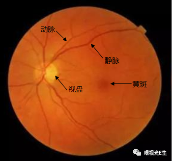 检查顺序一般为:视乳头,血管,视网膜和黄斑.