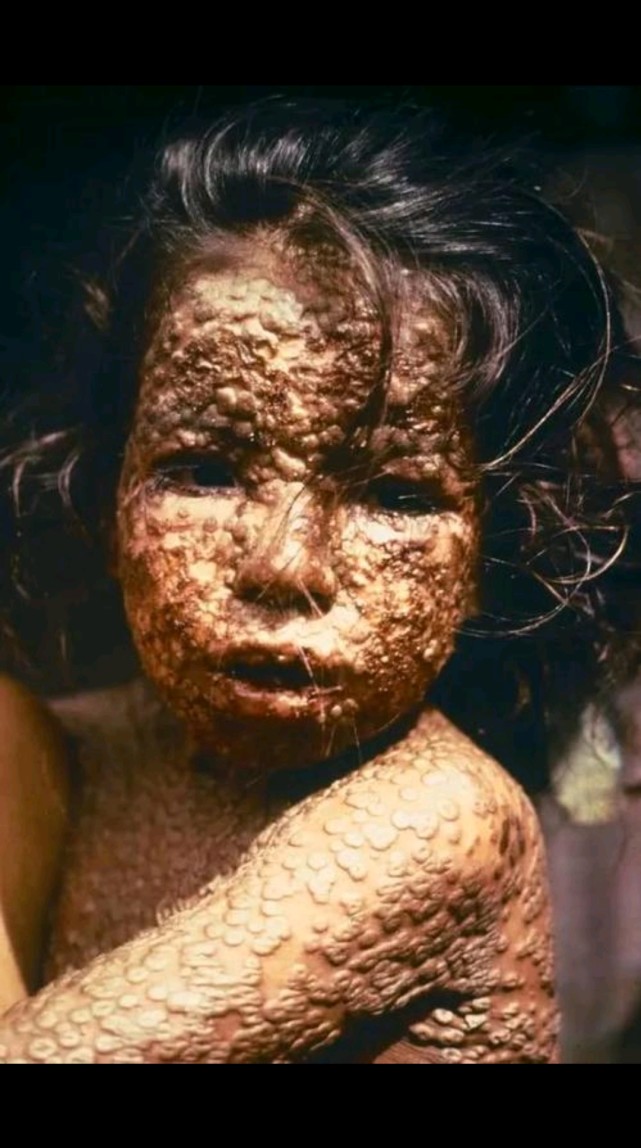 黑死病到底有多恐怖!