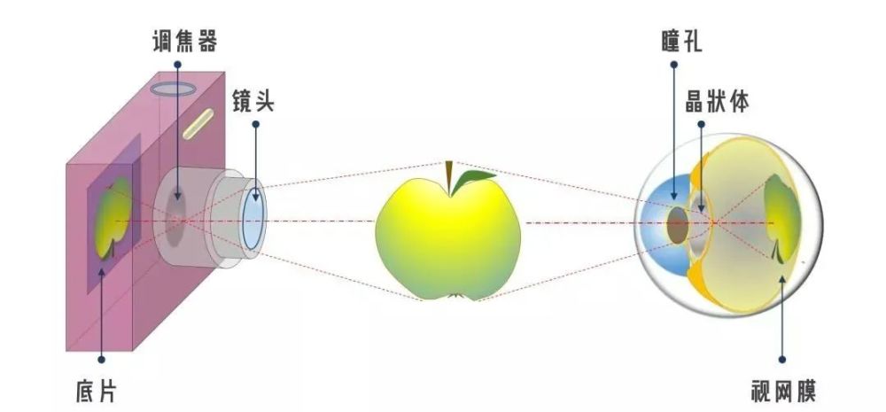 【视觉训练≠近视康复】孩子近视了,需不需要做视觉训练?
