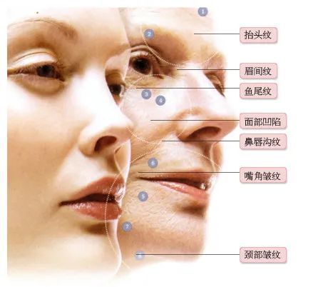 解密脸上皱纹面相的寓意!