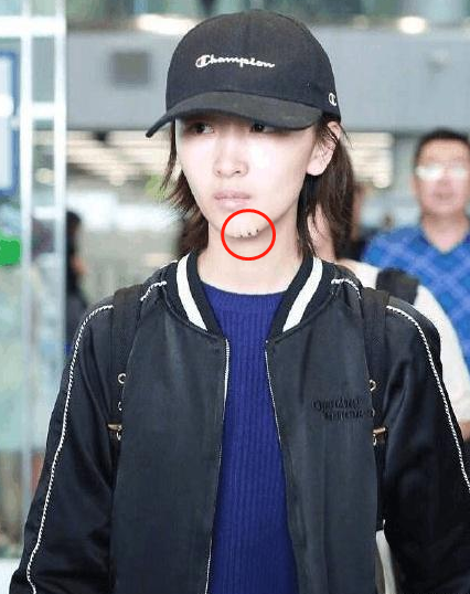 周冬雨深夜现身街头,双腿无力被助理搀扶,29岁身体引担忧