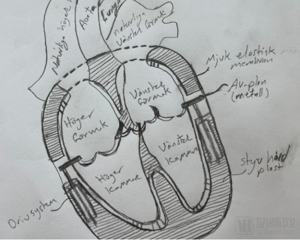 real heart:瑞典全人工心脏如何闯关心衰最后一公里?_腾讯新闻