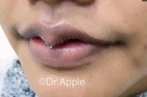 "嘴型"决定"命运"吗?盘点8种不同唇形,看看你属于哪种呢?