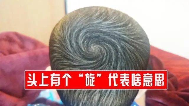 孩子头上的"旋"代表着什么?与智商和性格有关吗?今天来告诉你