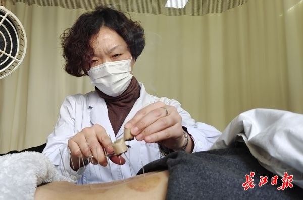 武汉市第三医院中医科医生正在为患者做"温针灸",结合针刺与艾灸之