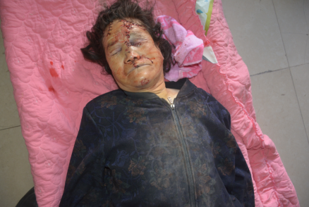 孙家川组)处发生一起车碰行人死亡道路交通事故,死者为一未知名女性