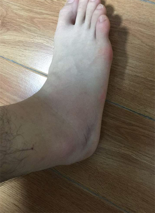 北京少年打篮球时受伤,去不了nba向篮球馆索赔485万,法院判了