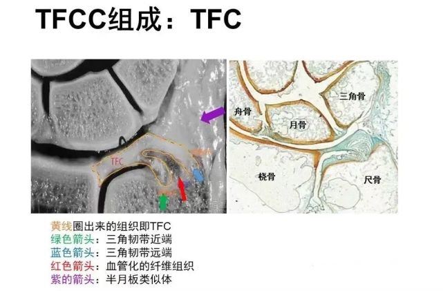 警惕tfcc找上門!