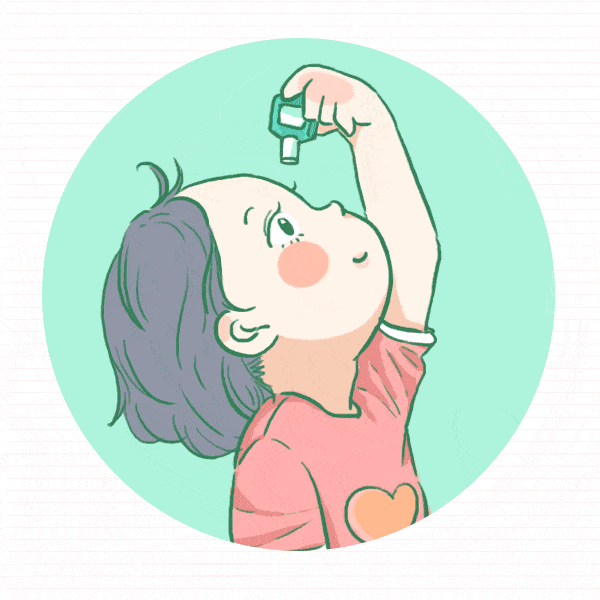 激素类的眼药水名称中多带有"松"字,如地塞米松,氟美松等.