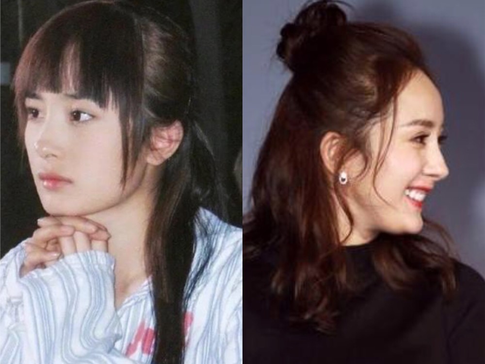 双下巴两颊下垂女明星v脸老得快还是小方脸不易垮