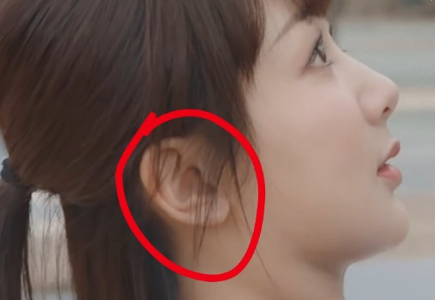 翻看贺顿高中时期的照片,她的耳朵并未出现任何问题,这个耳朵缺口,很