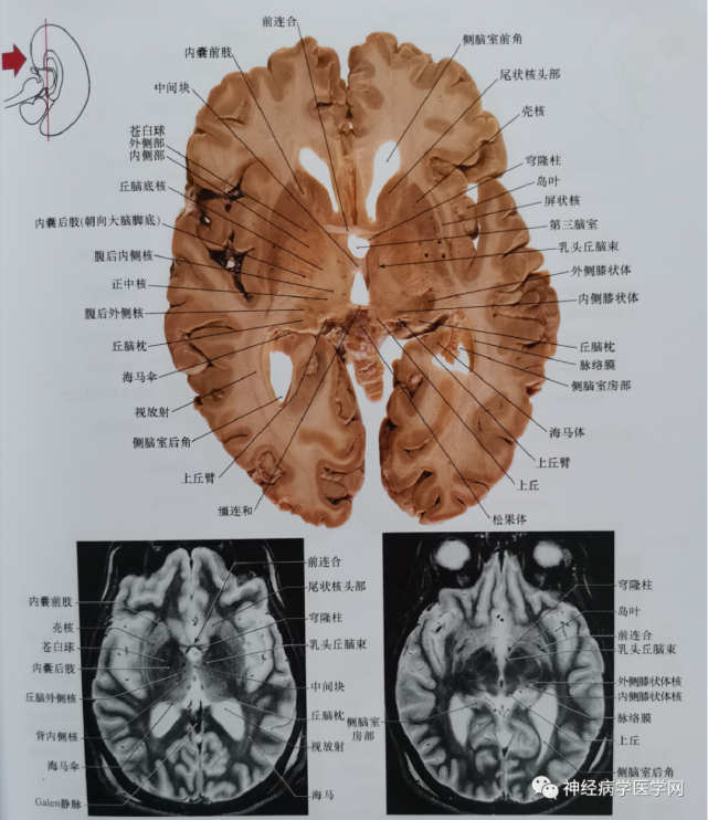 临床神经解剖图谱(断层影像 切片)