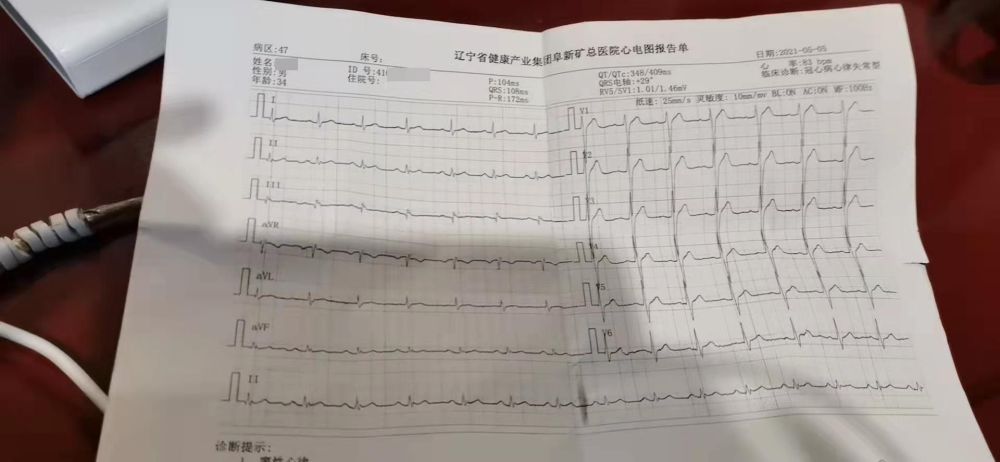 大学报道请假最多可以请几天