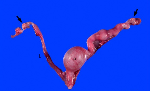 同窝4只小母猫(一起去绝育)发现2只都存在单侧子宫异常情况:亲姐妹