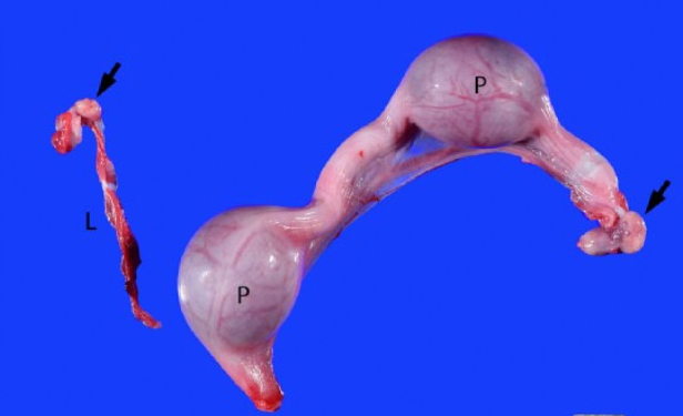 箭头代表卵巢内有黄体左子宫角 (l) 被取代(异常)而其中一只同时存在