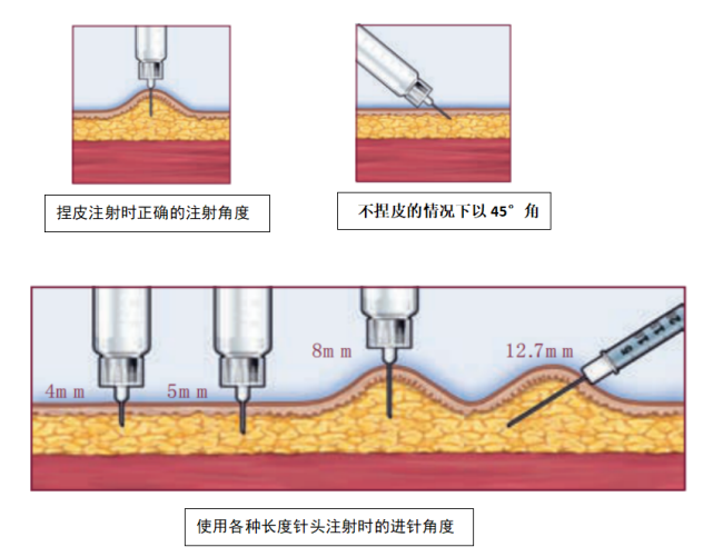 胰岛素打针时疼痛,降糖效果不理想?看看是否犯了这些错误!