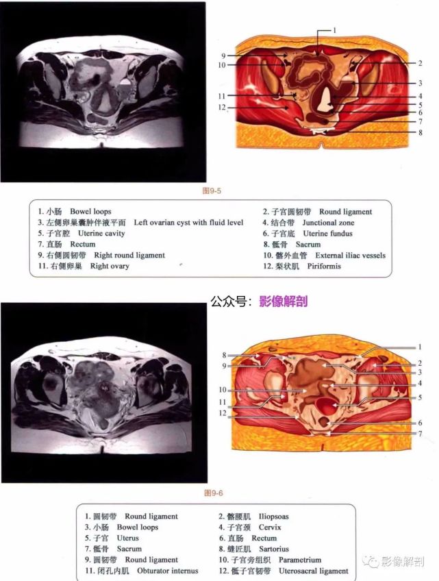 影像解剖▕盆腔