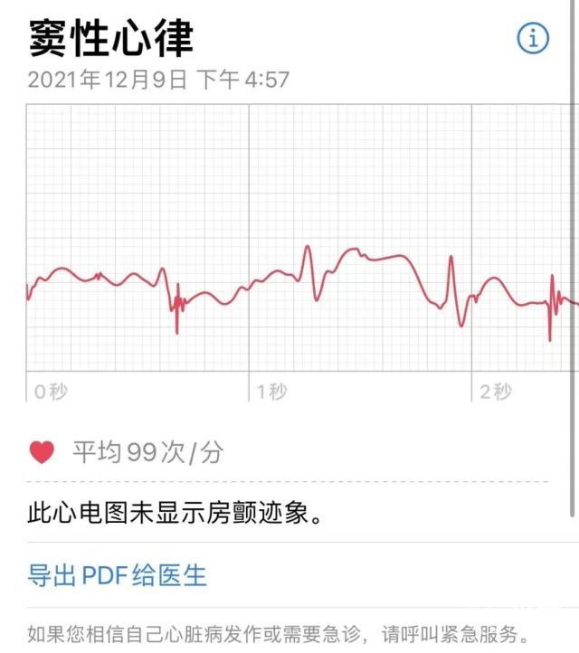 蘋果手錶心電圖功能解鎖支持4款機型快來看你的能不能用