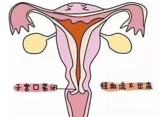 来月经站着下身有坠痛感怎么回事?