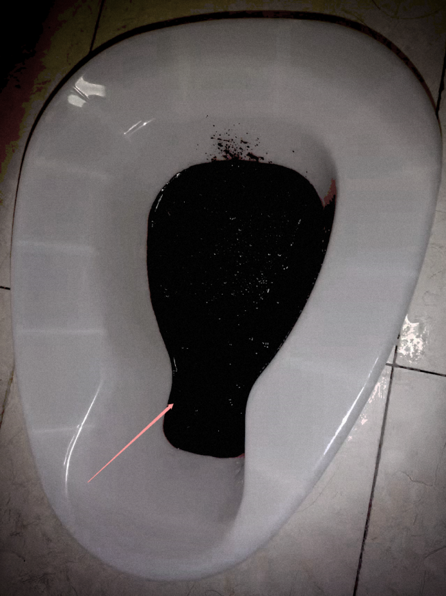 拉完屎以后千万记得回头看一眼对你有好处