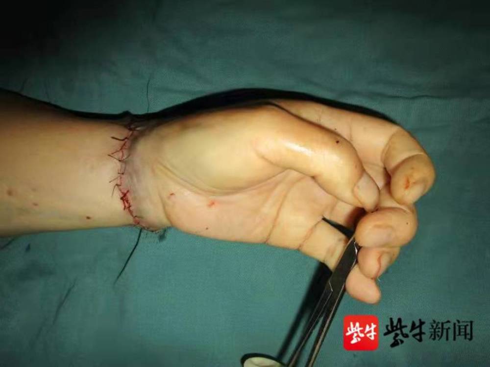 苏州一患有抑郁症的老人在家自残剁掉左手_腾讯新闻