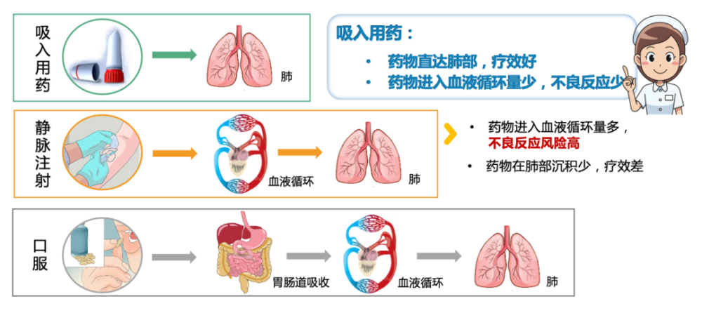 長期規範治療——哮喘控制的關鍵