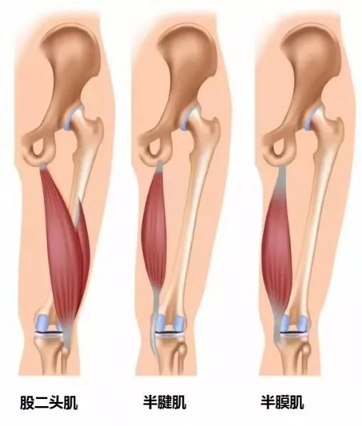 被冷落的腘绳肌也许是解决你腰腿疼的关键