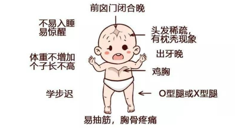 维生素d要不要补?不重视,小心肋骨外翻
