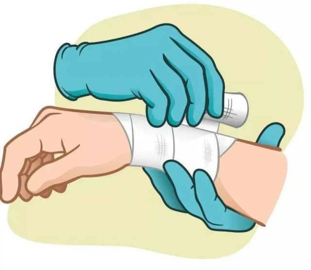 清洁,新生肉芽创面,还可加用凡士林油纱覆盖以减轻换药时患者的痛苦