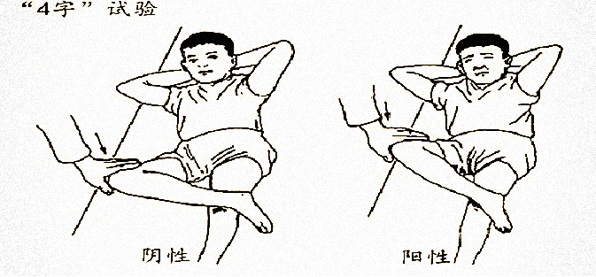 强直性脊柱炎患者如何识别复发征兆?_腾讯新闻