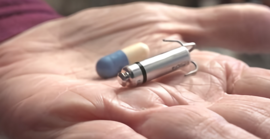 首例植入又一巨头争霸无线起搏器百亿市场