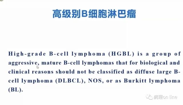 高級別b細胞淋巴瘤