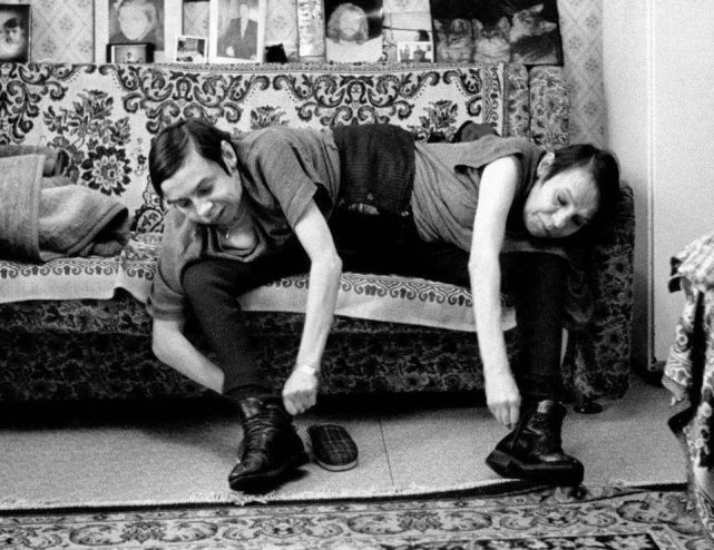 古代连体人如何结婚假如一个先挂了另一个是带尸体生活