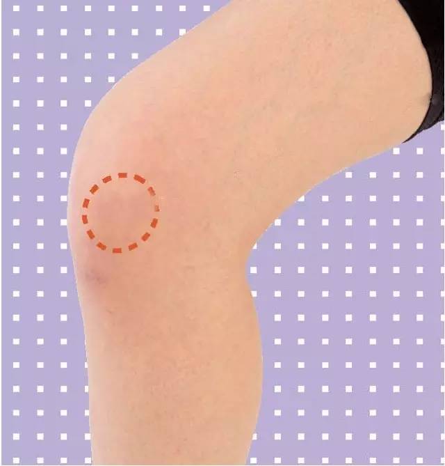 如果感到剧烈疼痛的话,是由于大量的练习刺激了膝盖窝的神经造成的.