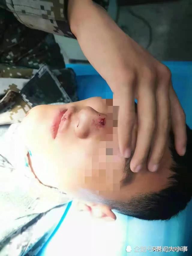 邯郸肥乡二中学生在宿舍内受伤，校方解释同学“玩闹”所致