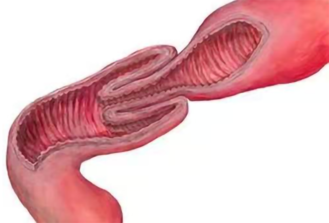 健康孩子不停哭喊肚子疼家长千万别掉以轻心