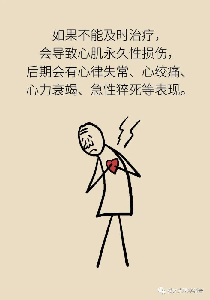 不疼不痒的心脏缺血危险性更大要高度重视