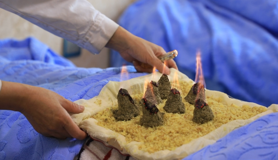 三九灸开始了请速速预约